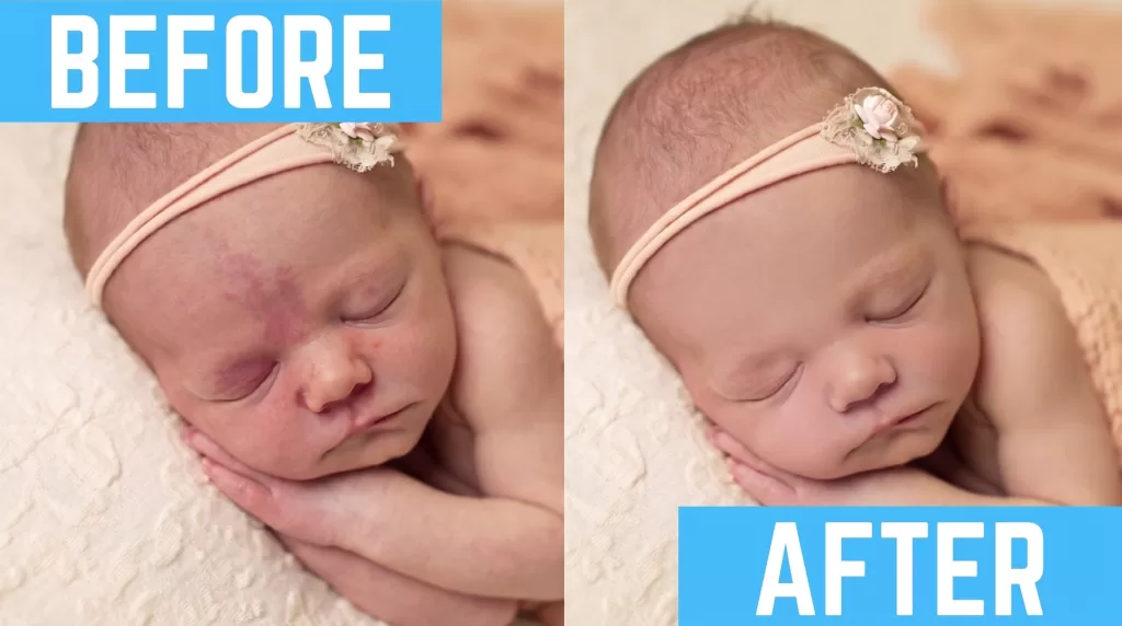 Before and after example of frequency separation skin retouching