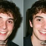 Before and after red eye removal on a man's flash portrait
